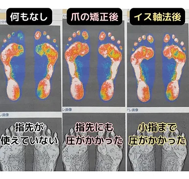 事例